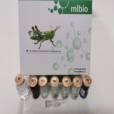 RRP8 定量检测试剂盒 / 人核糖体RNA处理蛋白8(RRP8)48T/96T回收率