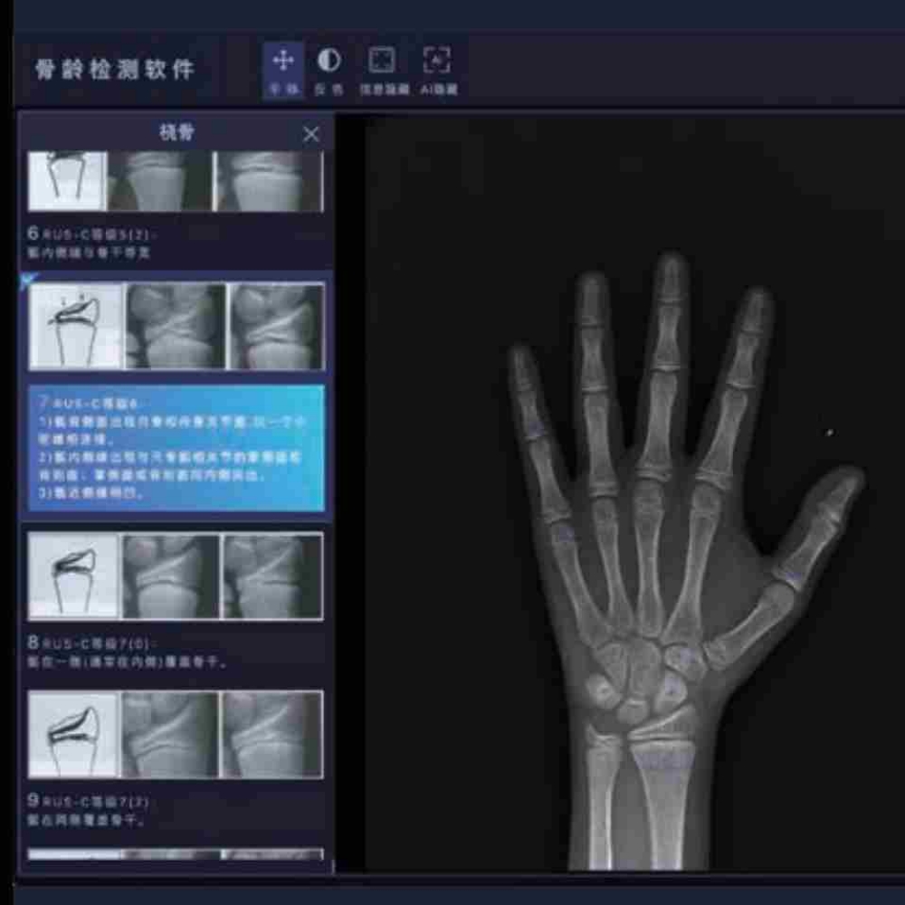安智康 操作简单智能化 体检机构筛查 IDR-302HR-WF 骨龄分析仪