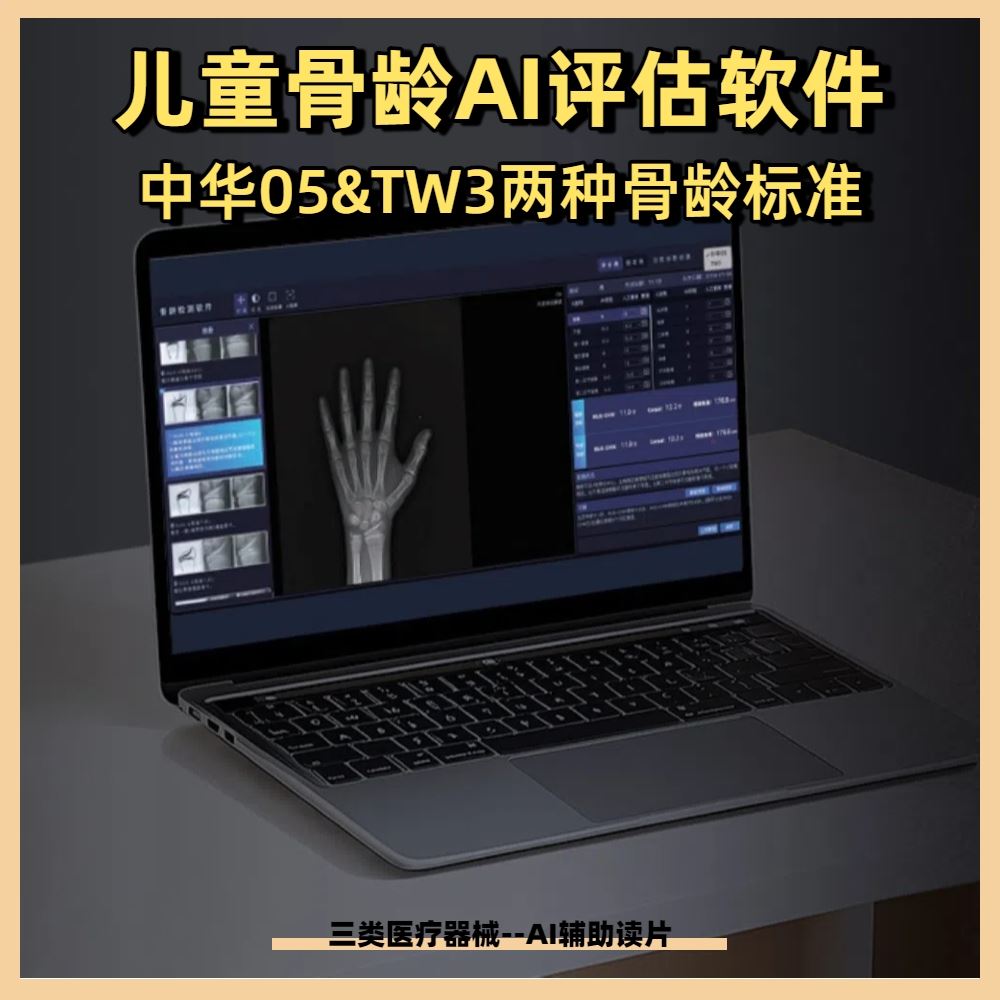 安智龄 AZK_Bone_Age 误差仅0.28岁内 检测骨龄的软件