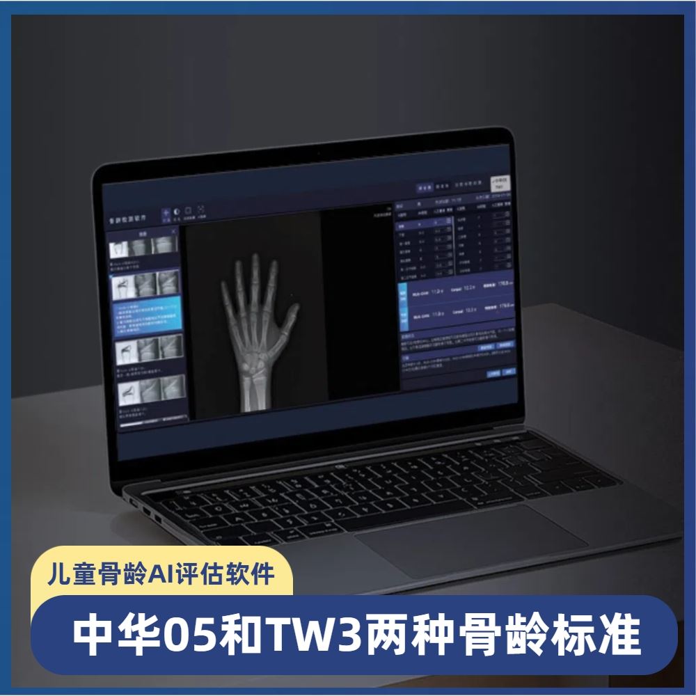 安智康生物 高效赋能读片 儿童骨龄检测软件 AZK_Bone_Age