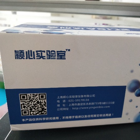 人抗斑疹伤寒抗体anti typhus AbElisa试剂盒