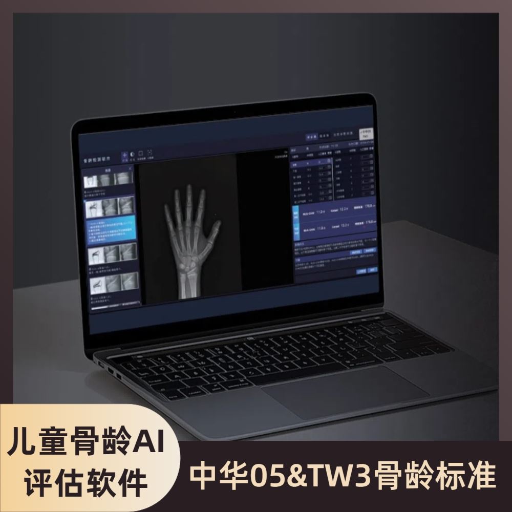 安智龄 高效赋能读片 骨龄分析软件 AZK_Bone_Age