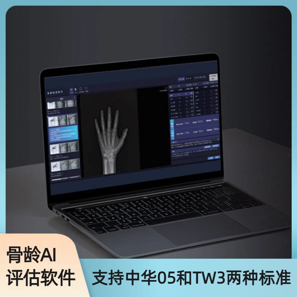 安智龄 高效赋能读片 中华05骨龄评估软件 AZK_Bone_Age