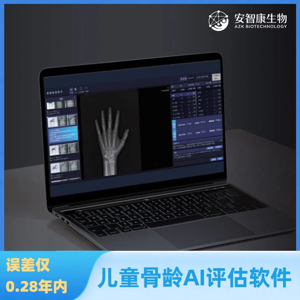 安智龄 中华05骨龄软件 AI赋能判读 AZK_Bone_Age