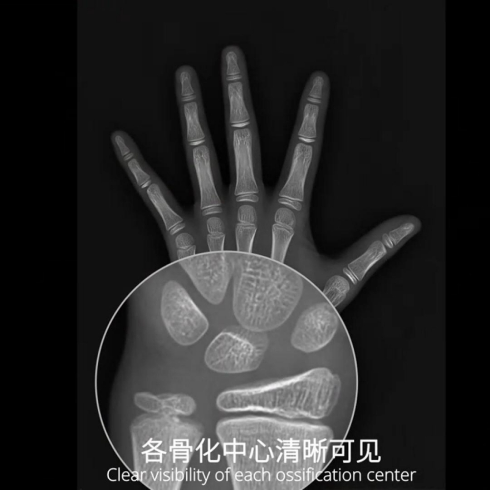 安智康生物 三类医疗器械 骨龄测定软件 AZK_Bone_Age