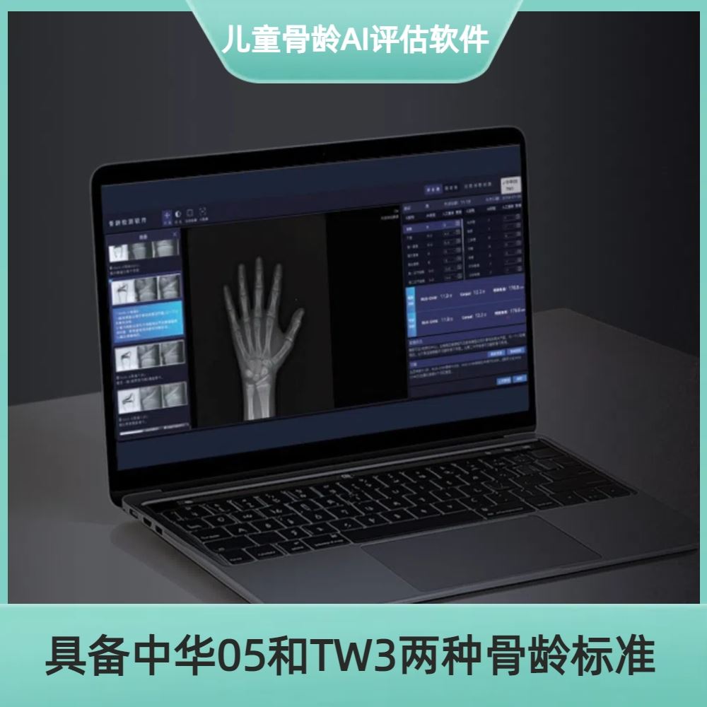 安智康生物 骨龄测定年龄软件 高效赋能读片 AZK_Bone_Age