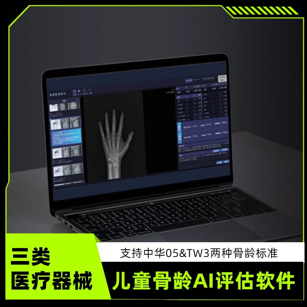 安智康生物 AI赋能判读 检测骨龄的软件 AZK_Bone_Age