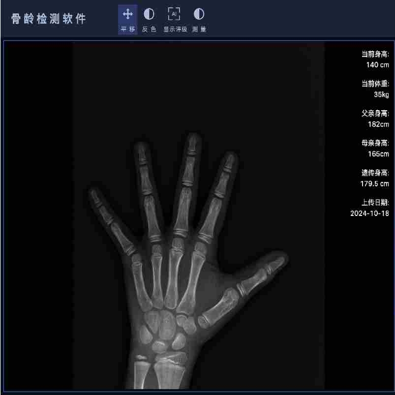 安智康 骨龄测评仪器 920万超高清像素 体育院校选材 IDR-302HR-WF