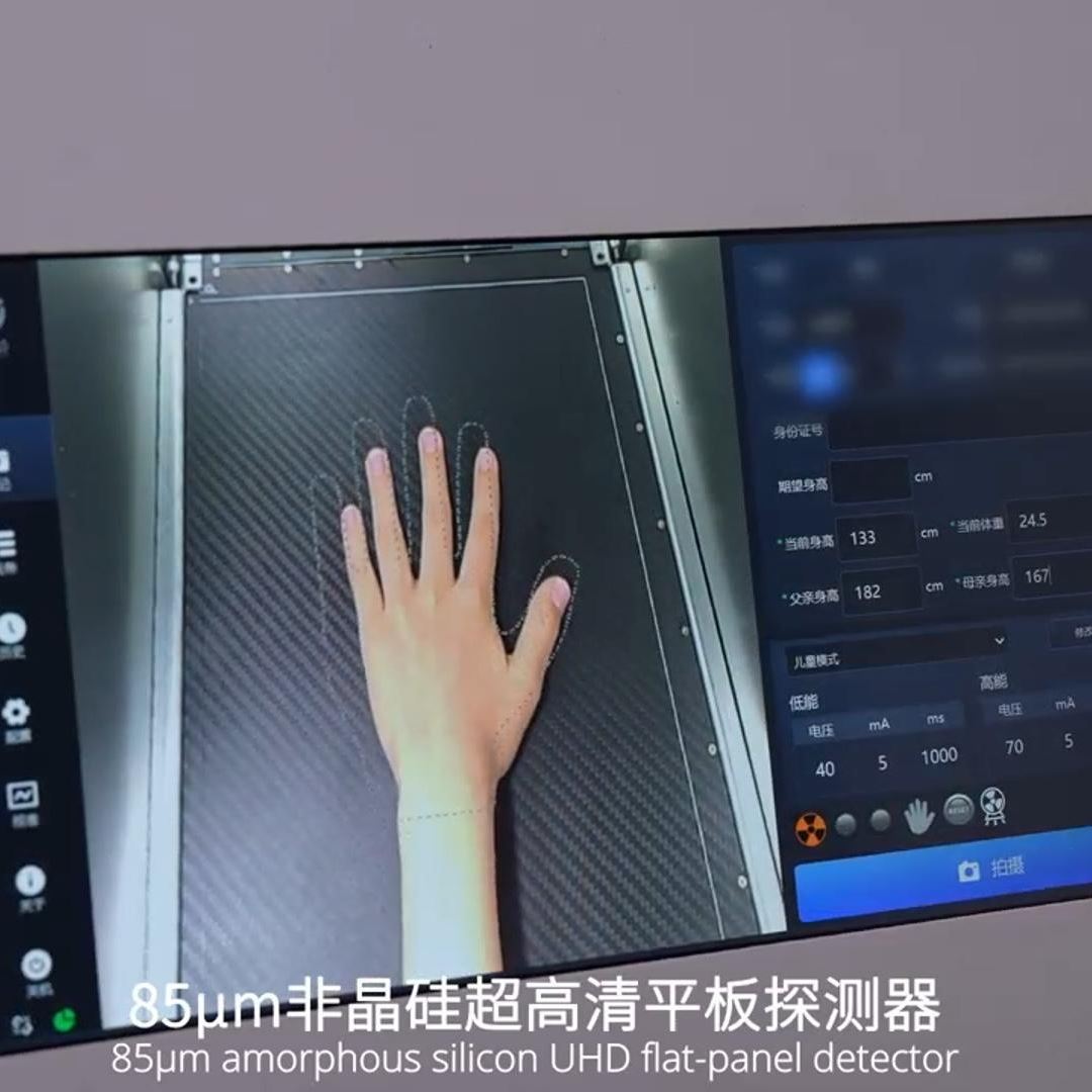安智康 骨龄检查仪 分析骨骺等级 儿科儿保科 IDR-302HR-WF