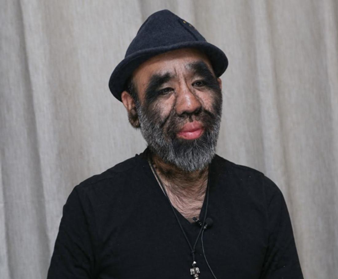 于震寰:外貌并不能决定一个人的价值和能力 于震寰,中国第一毛孩,因着