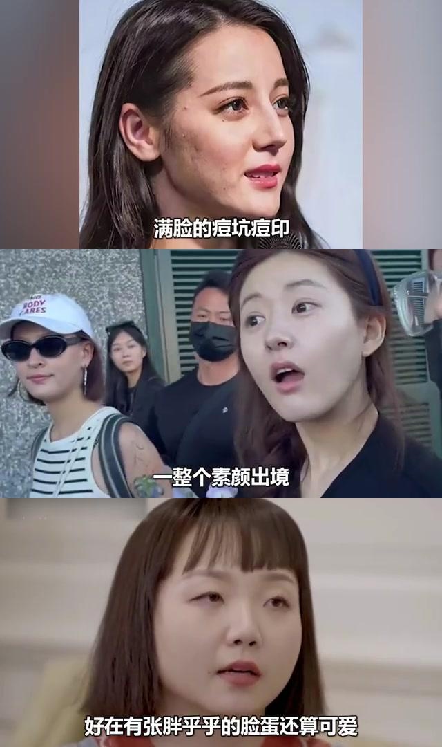 痘坑特别严重的女明星图片