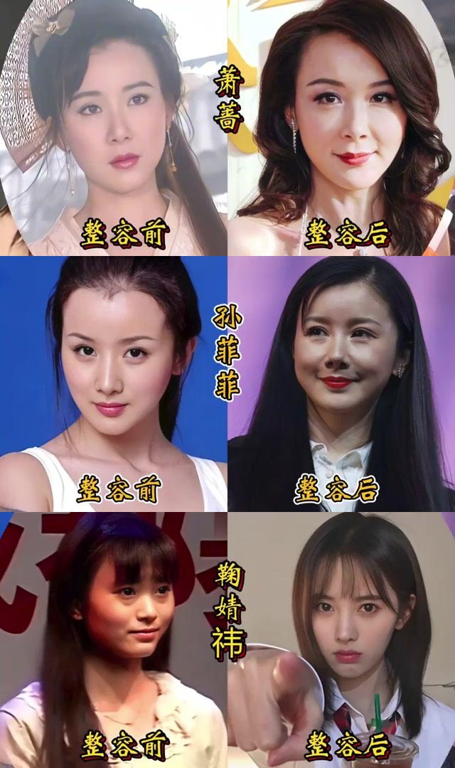 24位女性整容前后对比,哪位美成了天仙,哪位令人心疼?