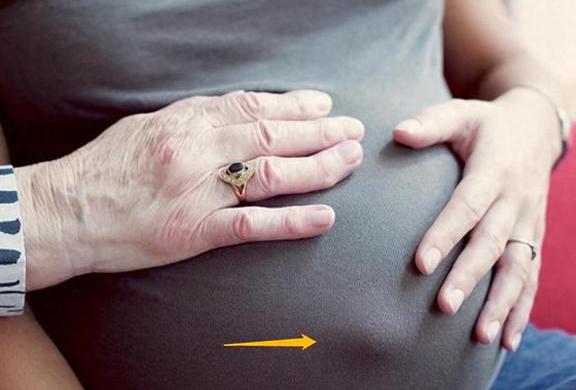 孕期肚子鼓包示意图图片