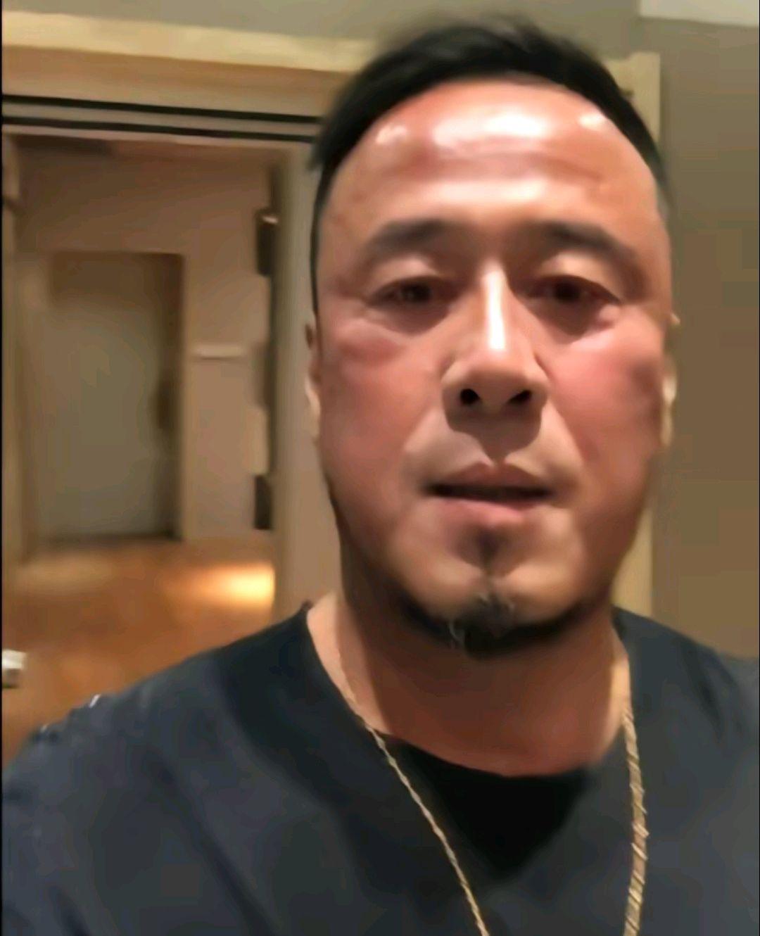 杨坤长沙演出后被暴打 杨坤近日在长沙演出后,返回酒店途中被不明身份