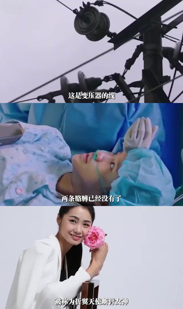 人生的坚韧与美好 杨佩是一个在困境中绽放的美丽女孩,她失去双臂后并