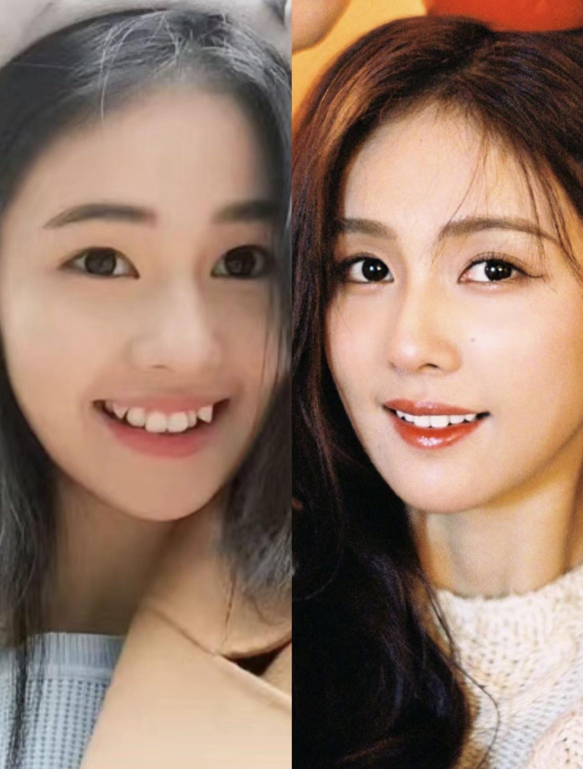 白鹿:从初恋感网红到影视大女主 白鹿矫正了牙,效果堪比换脸,她的脸有