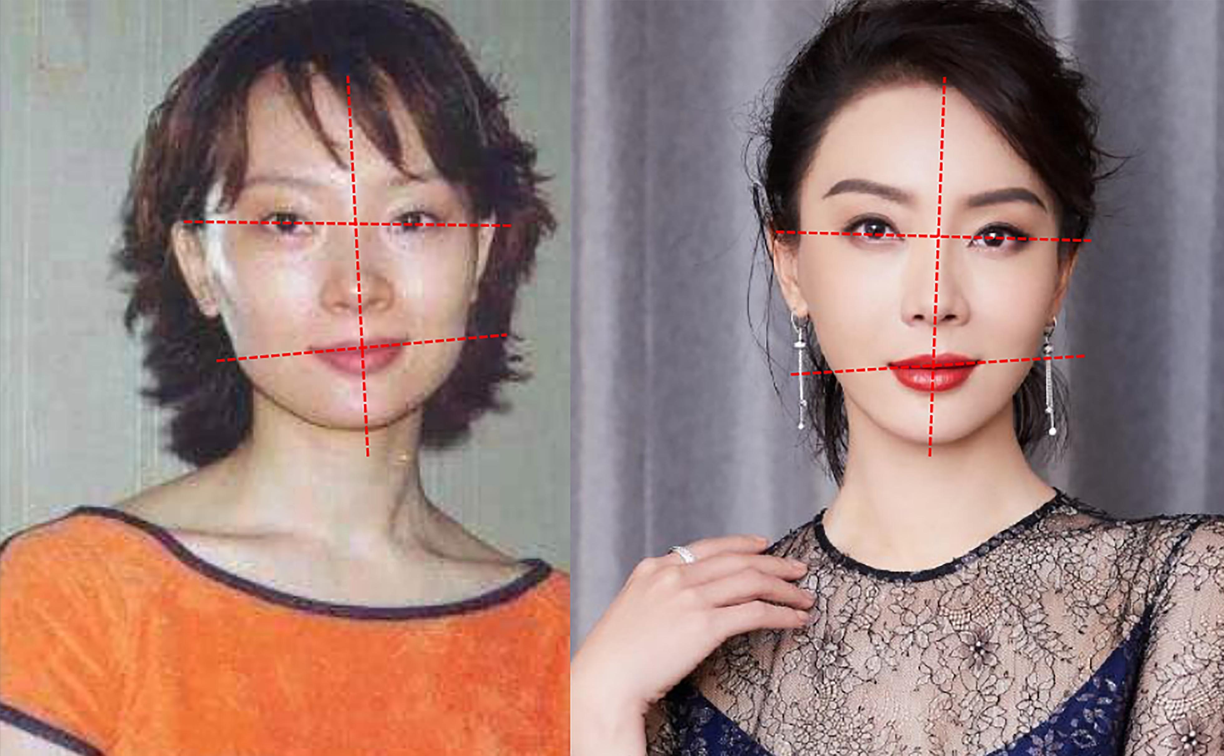 这7位整容上瘾的女明星 这7位女明星为了保持年轻美丽的外貌,选择动