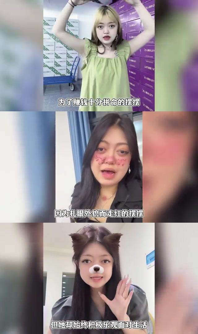 揭秘背后隐藏的娱乐业辛酸 年仅20岁的网红摆摆小公主因克鲁宗综合征