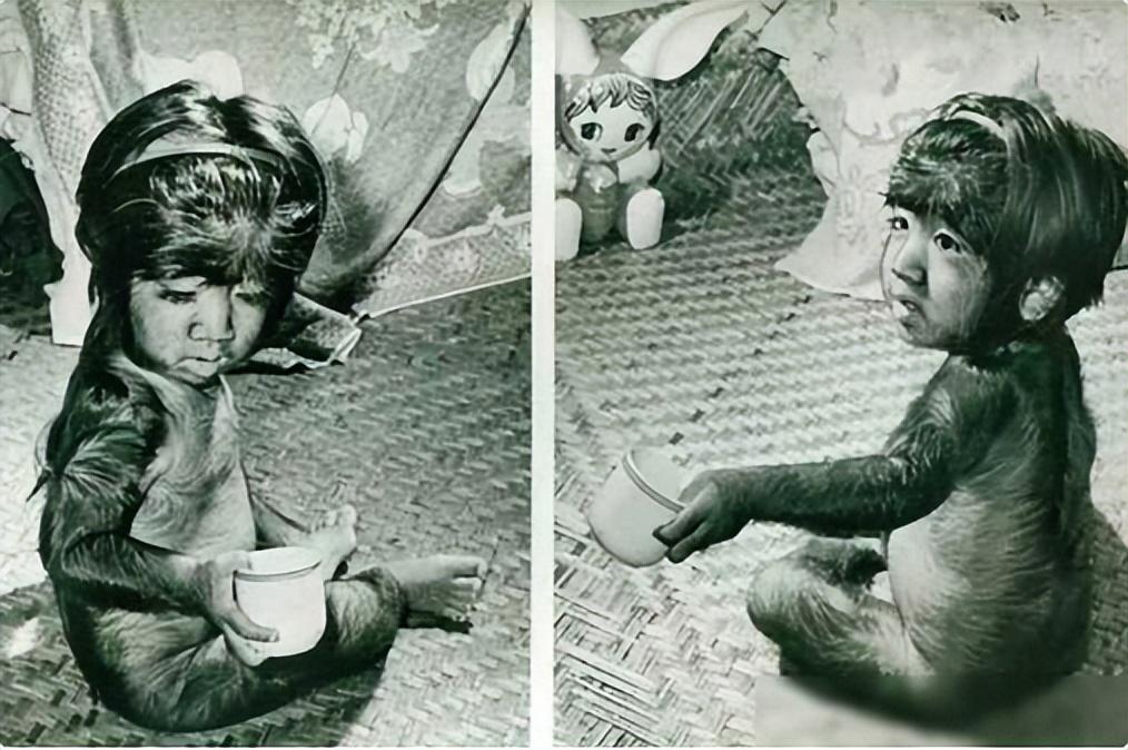 毛发传奇:于震寰,从"毛孩"到"金刚" 于震寰,中国第一毛孩,身上96%的