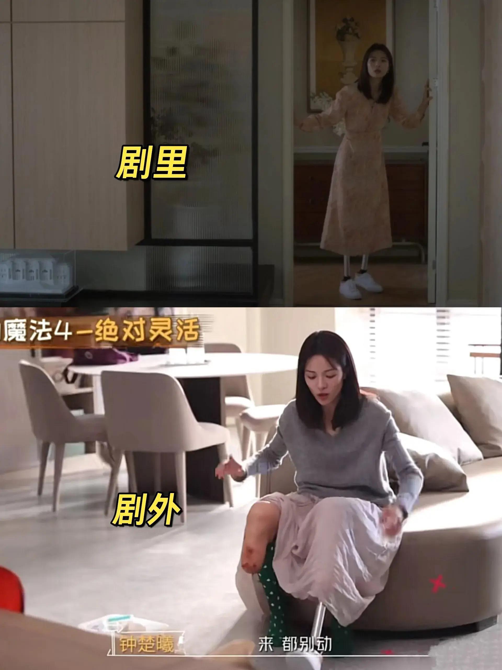 电视剧《如果奔跑是我的人生》中,钟楚曦的表演和逼真的假肢成为了