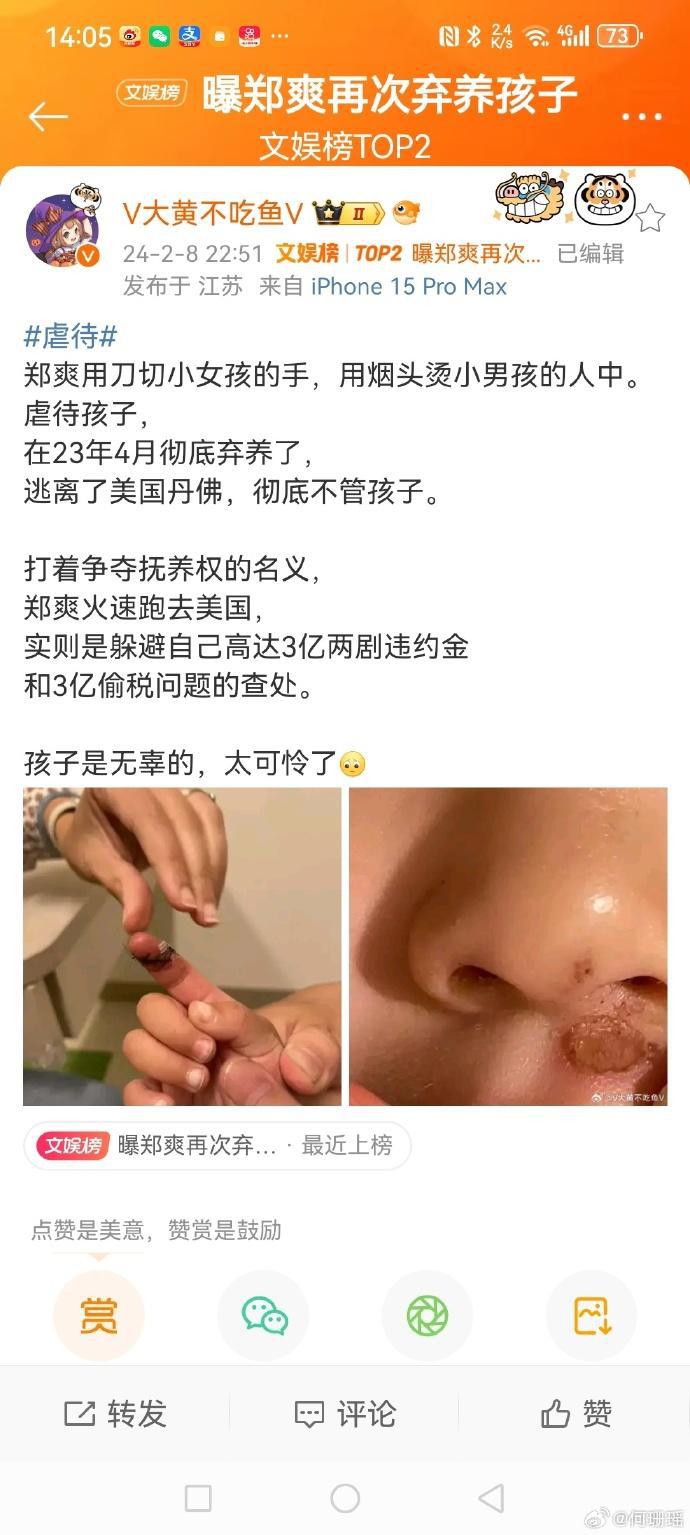 郑爽张恒孩子录音图片