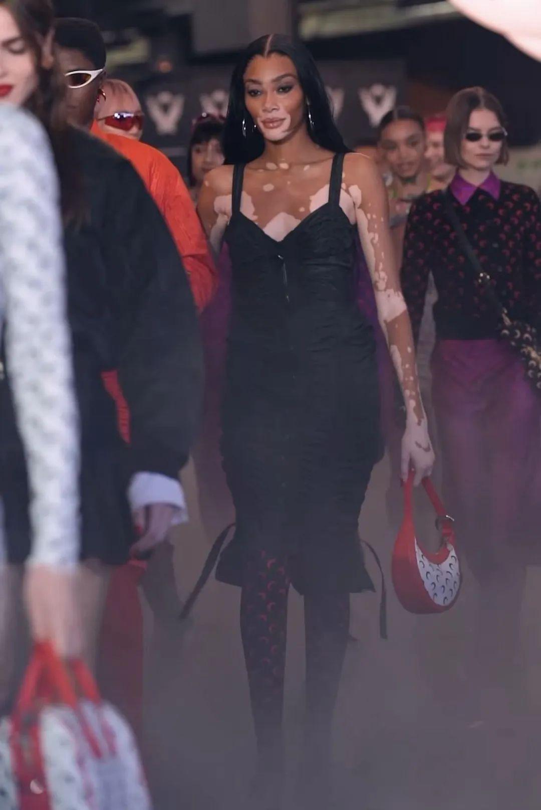 库兹马白癜风女友太贴心,靓仔变形记 凯尔·库兹马的女友温妮·哈洛是