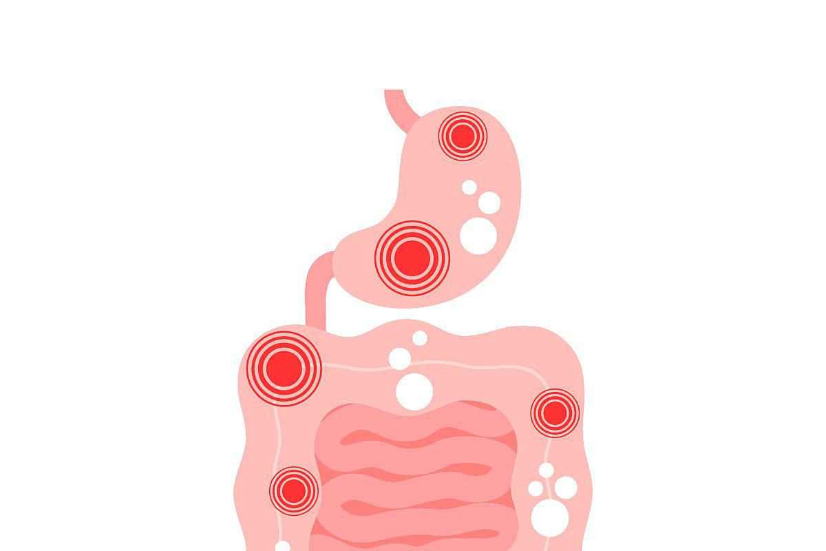 胃肠图卡通图片