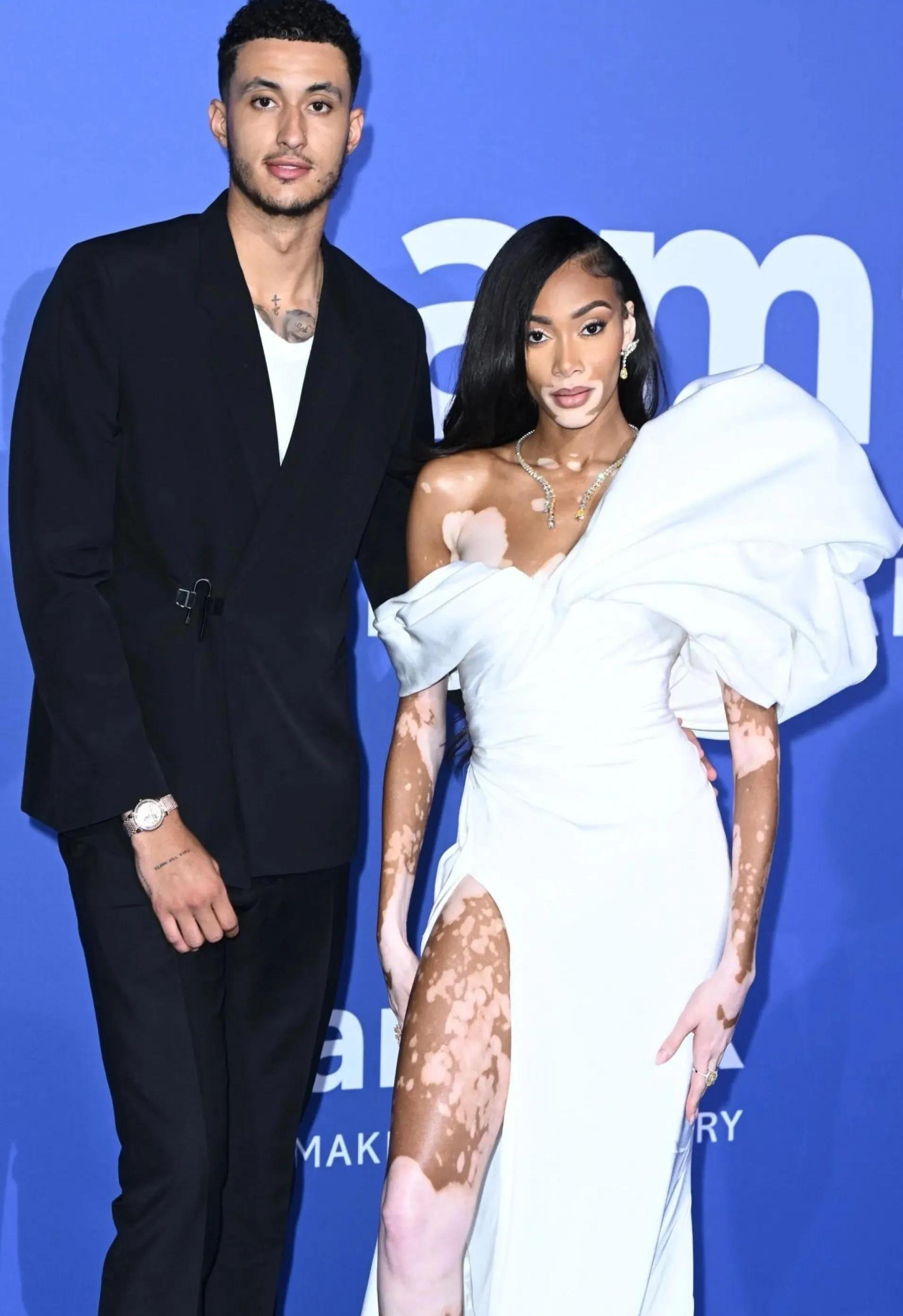 库兹玛与白癜风超模温妮·哈洛的浪漫爱情故事 前湖人队球员库兹玛与