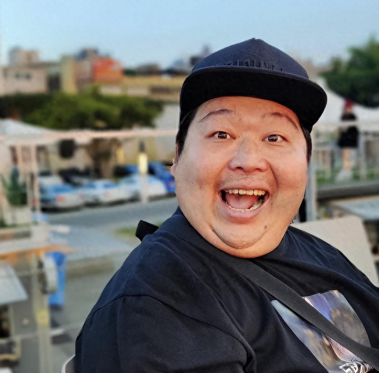 台湾通告王山猪因红斑狼疮去世,享年38岁,警醒世人健康为重 台湾搞笑