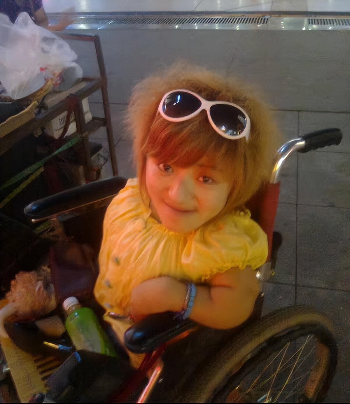 逆境中的绽放,千万身价的传奇人生 李喜梅,一个身高仅80厘米的"瓷娃娃