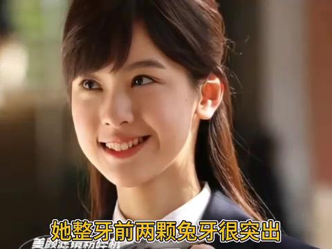 陈都灵整牙后颜值飙升,整齐牙齿更添魅力! 陈都灵整牙后的变化真大!