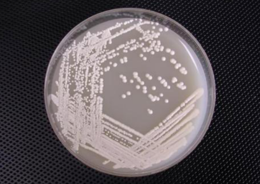 润滑油脱蜡微生物的生长条件