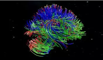 脑网络组图谱，让人脑有了精准“地图”