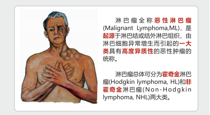 【胖熊科普 】一文讲清楚：消化道肿瘤的高危人群和危险信号有哪些？