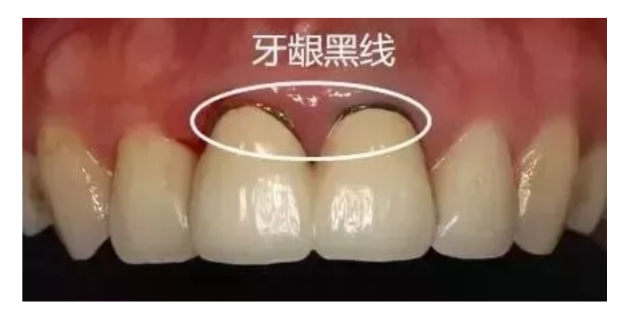 正在上传...