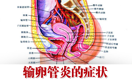 慢性輸卵管炎的症狀有哪些該怎樣預防