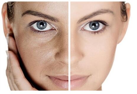 恢复皮肤年轻的产品,可有效地消除人面部皮肤各种原因如皱纹和凹陷造