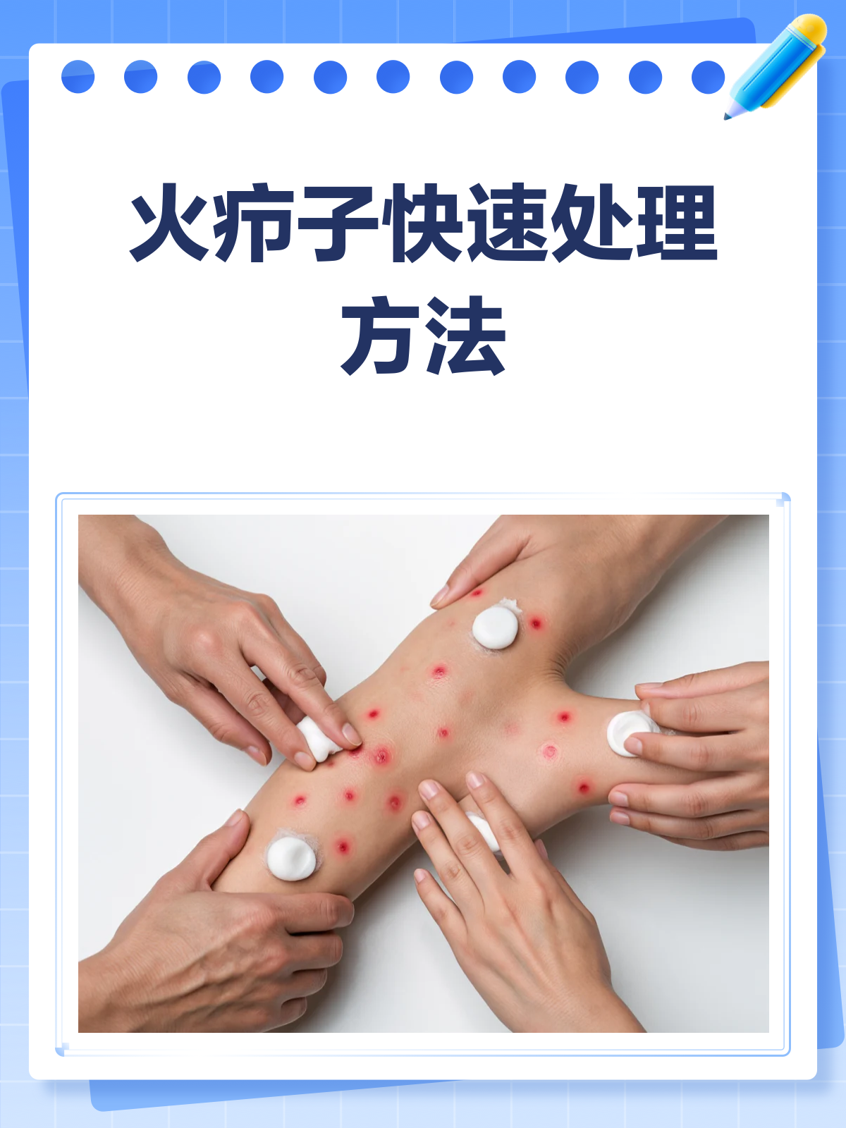 火疖子来袭?快速处理方法大揭秘🔥