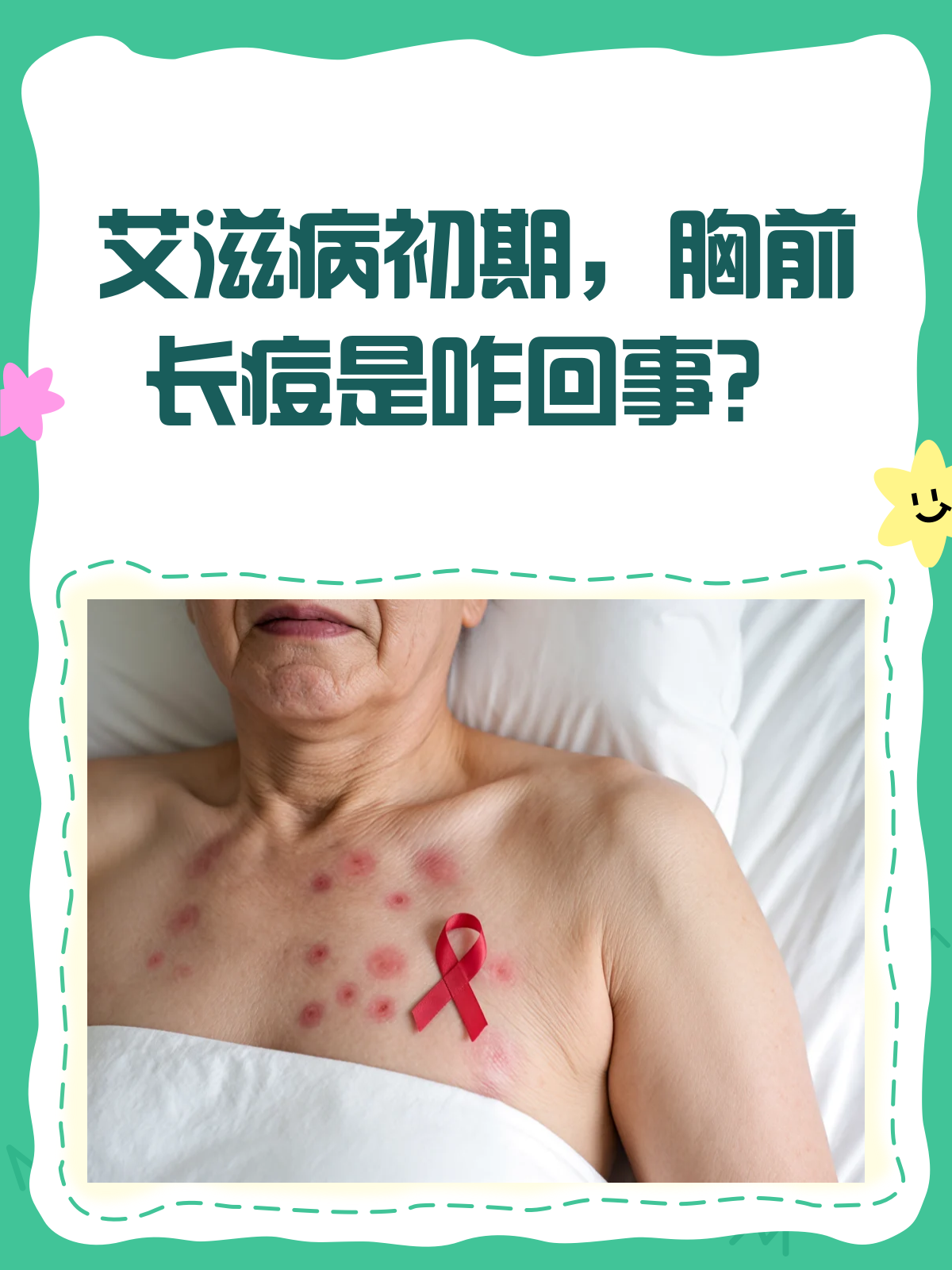 艾滋病初期,胸前长痘是信号?🚨