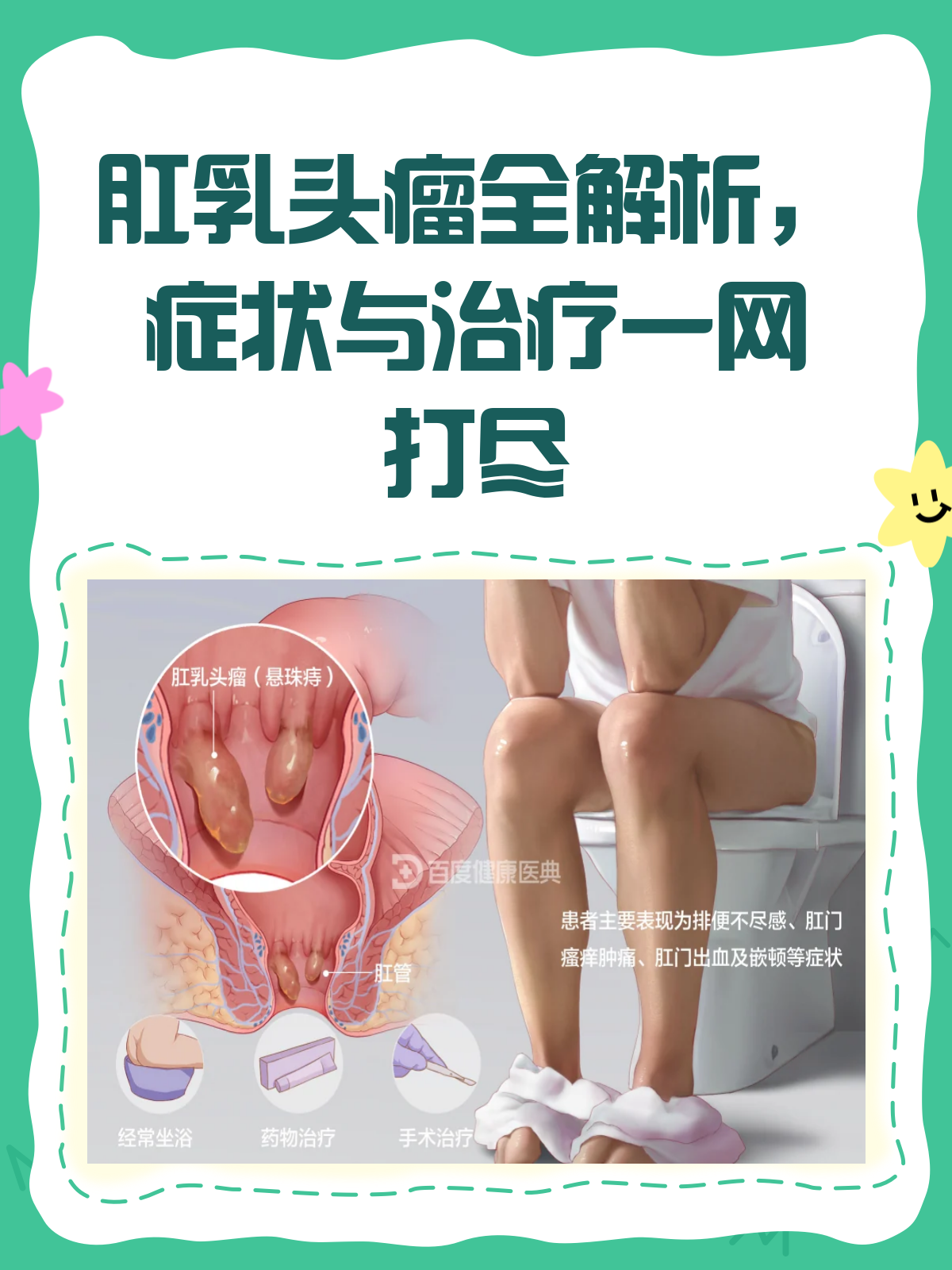 肛乳头瘤?别怕,一文读懂它!👀